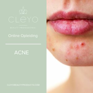 ACNE ONLINE TRAINING CLEYO BEAUTY PROFESSIONAL