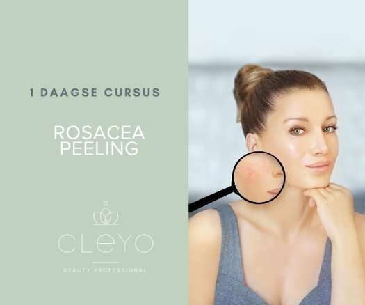 rosacea peeling opleiding cursus cleyo beauty professional